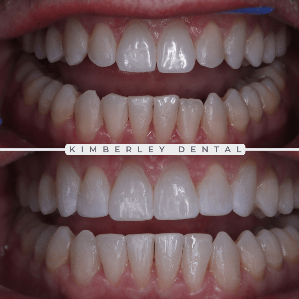 kimberley dental