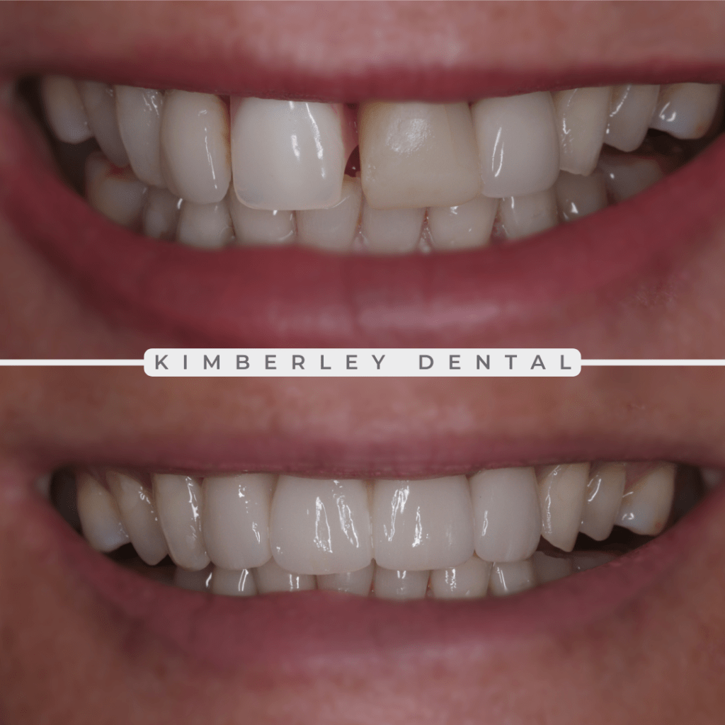 kimberley dental
