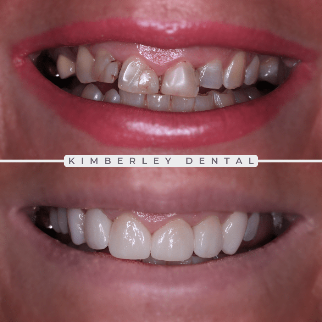 kimberley dental