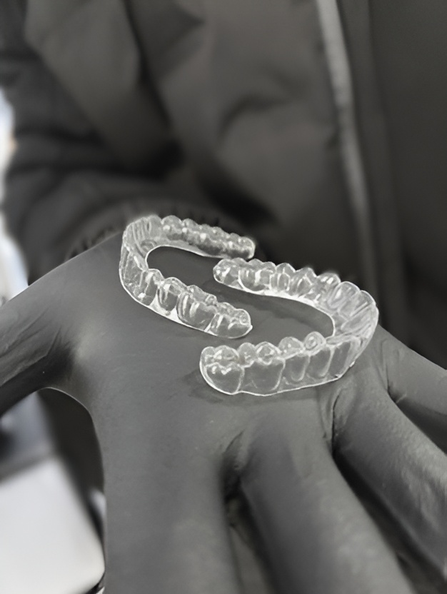 Clear Braces Nottingham